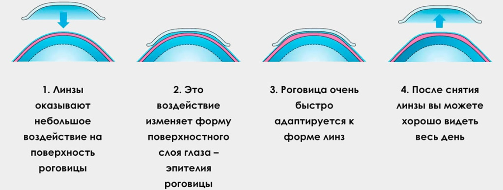 Подбор склеральных линз и ортокератологических линз